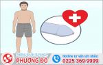 Dài bao quy đầu và cách khắc phục