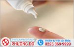 Nam giới cần lưu ý khi sử dụng thuốc bôi viêm bao quy đầu?