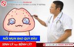 Mụn Ở Vùng Kín Nam, Nguyên Nhân Do Đâu Dẫn Đến