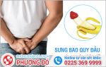 Tại Sao Bị Sưng Bao Quy Đầu, Dấu Hiệu Cảnh Báo Bệnh Gì?