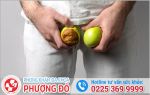 Viêm tinh hoàn và những điều nam giới cần biết