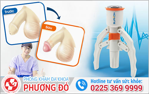 kỹ thuật xâm lấn tối thiểu công nghệ Hàn Quốc