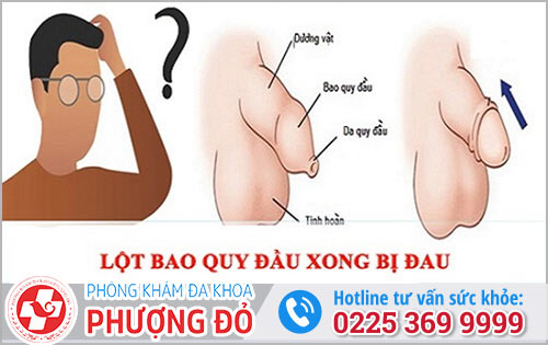 Lột bao quy đầu bị đau có thể là do hẹp bao quy đầu