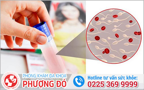 Viêm nhiễm cơ quan sinh dục có nguy cơ gây xuất tinh ra máu 