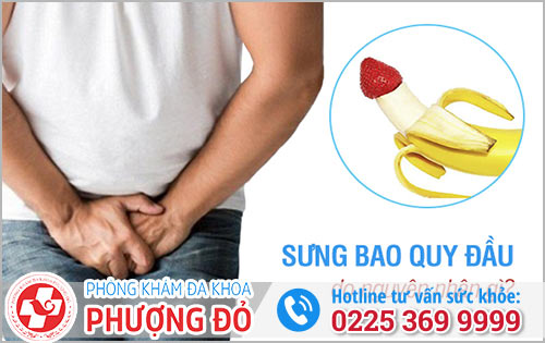 Tại Sao Bị Sưng Bao Quy Đầu?