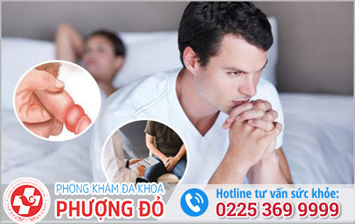 Cách xử lý sưng bao quy đầu