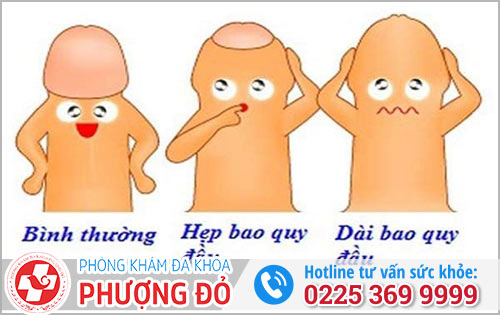  bệnh lý thường gặp ở bao quy đầu nam giới